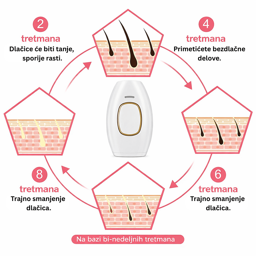 IPL Epilator - TryPure.rs
