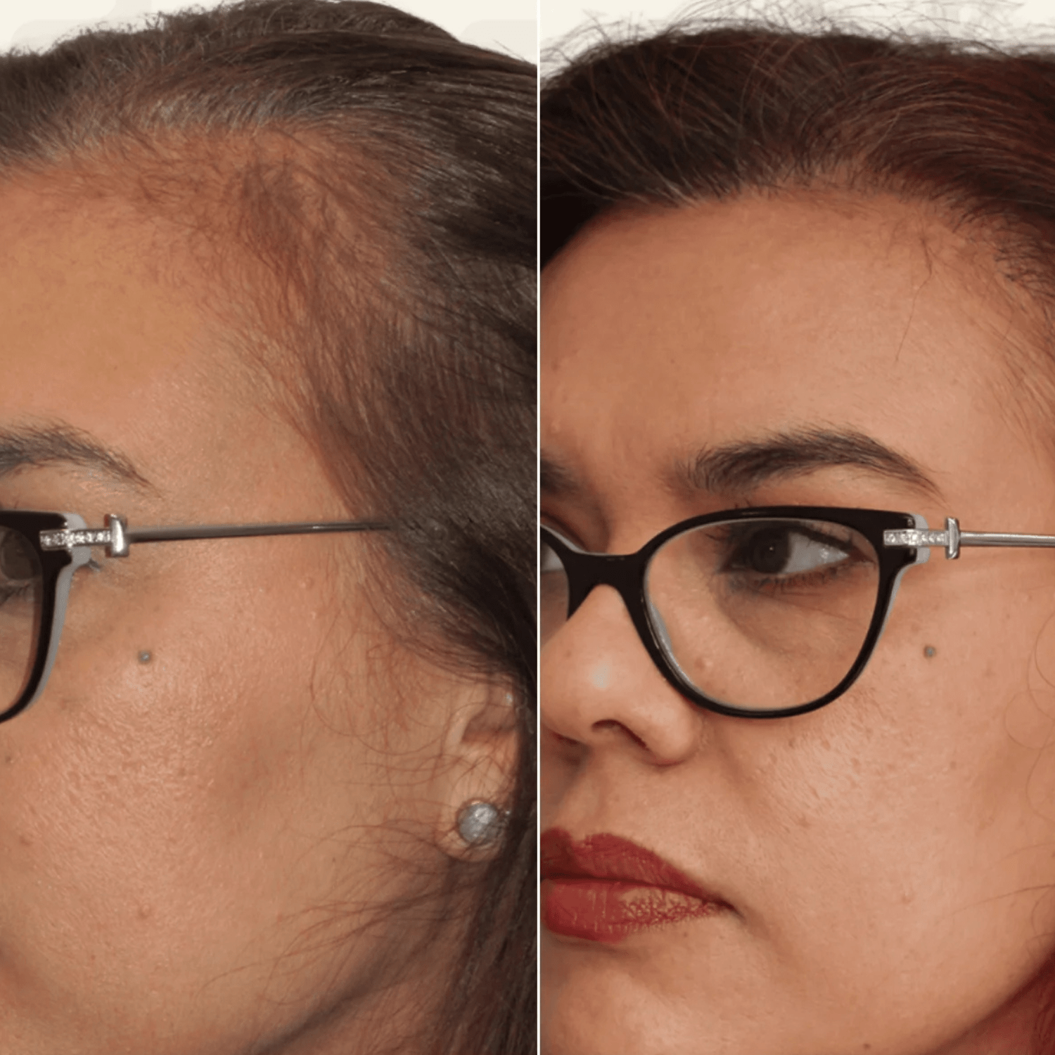 Led Masažer za glavu i negu kose - TryPure.rs