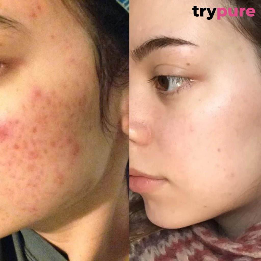 Pure Care Box - TryPure.rs