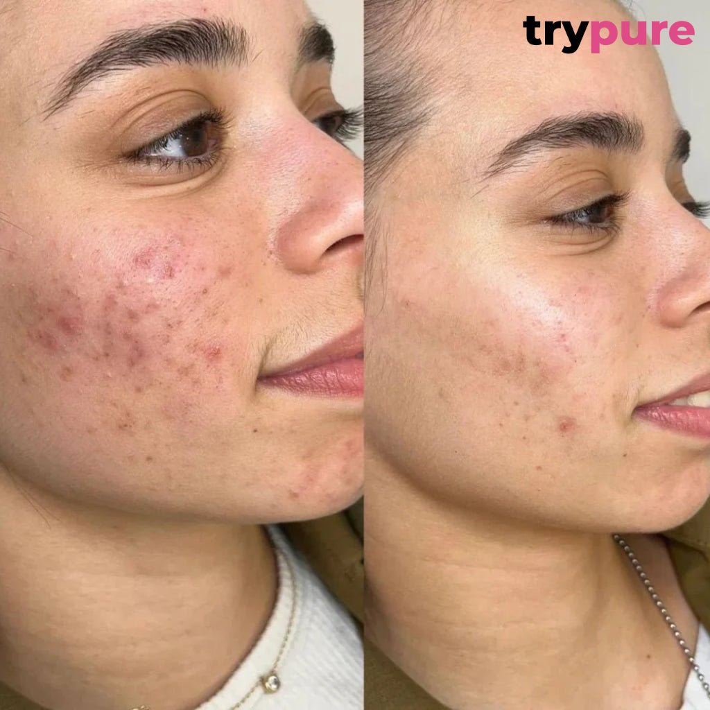 Pure Care Box - TryPure.rs