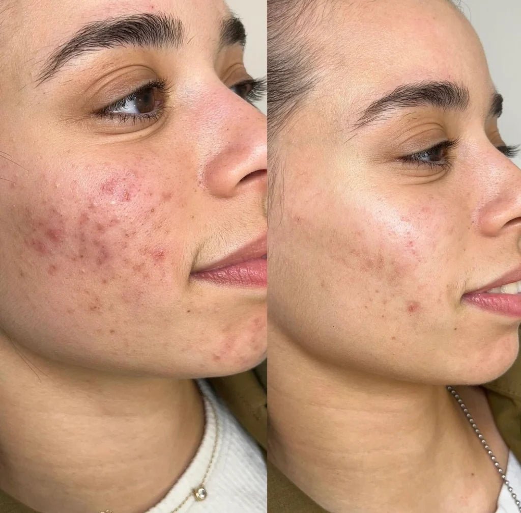 Pure Care Box - Šatori za decu