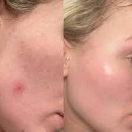 Pure Face Ice Box - TryPure.rs