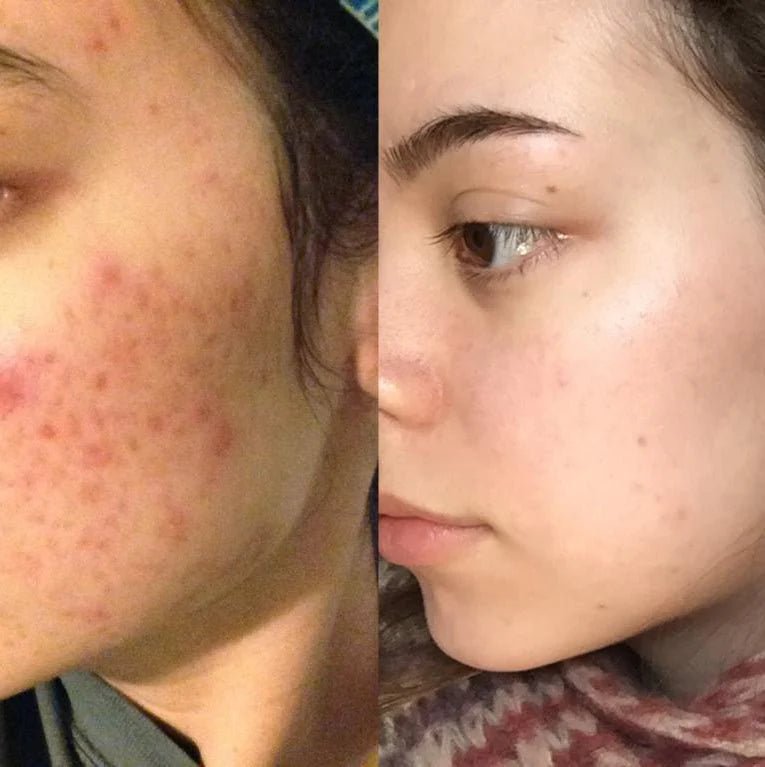 Pure Face Ice Box - TryPure.rs